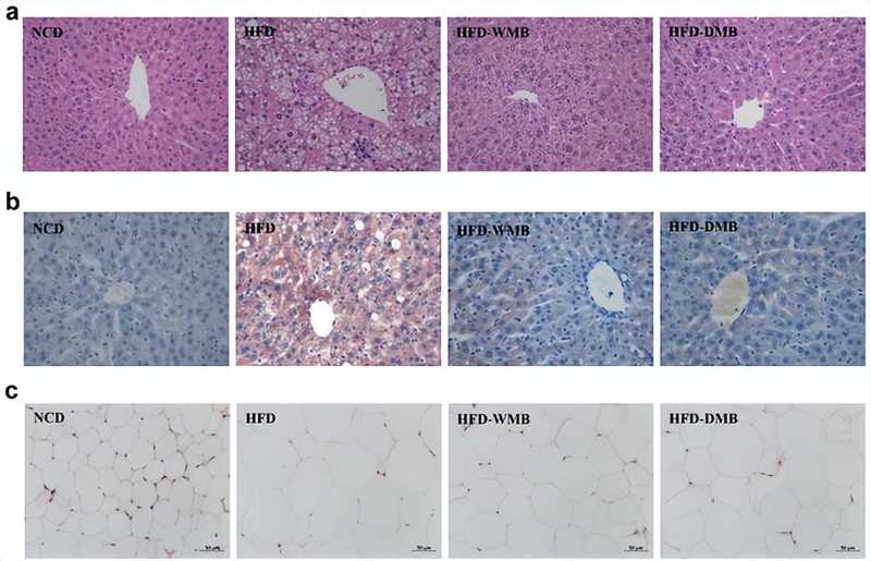  肠肝轴机制下的代谢调控：绿豆多酚对肝脏脂质沉积的干预路径解析 IT技术