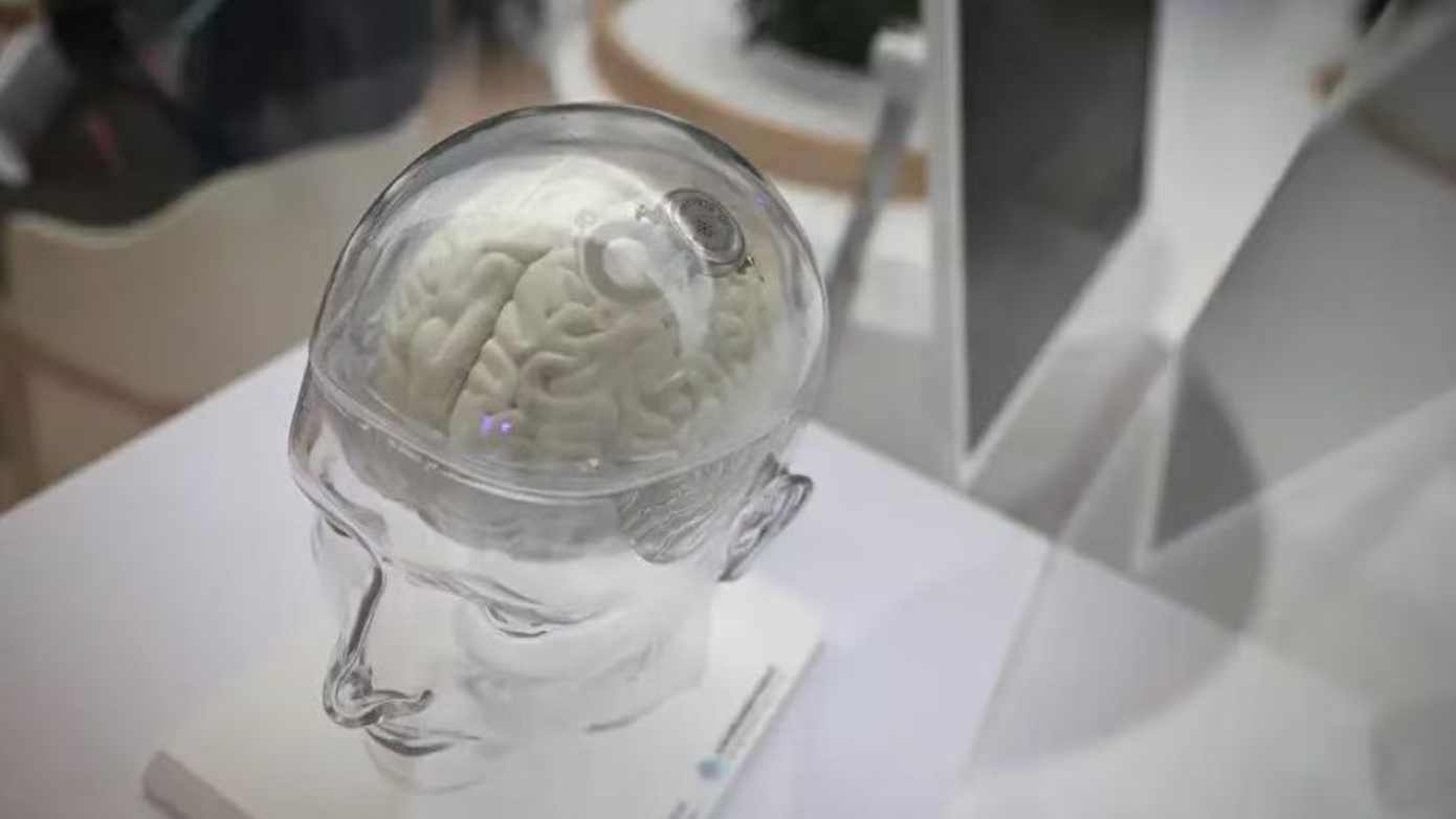  脑机接口技术突破：2026年“大规模生产”背后的关键技术革新 IT技术