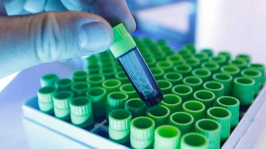  【技术深度】6MW5311获受理背后：迈威生物如何卡位血液瘤抗体药物赛道 新闻